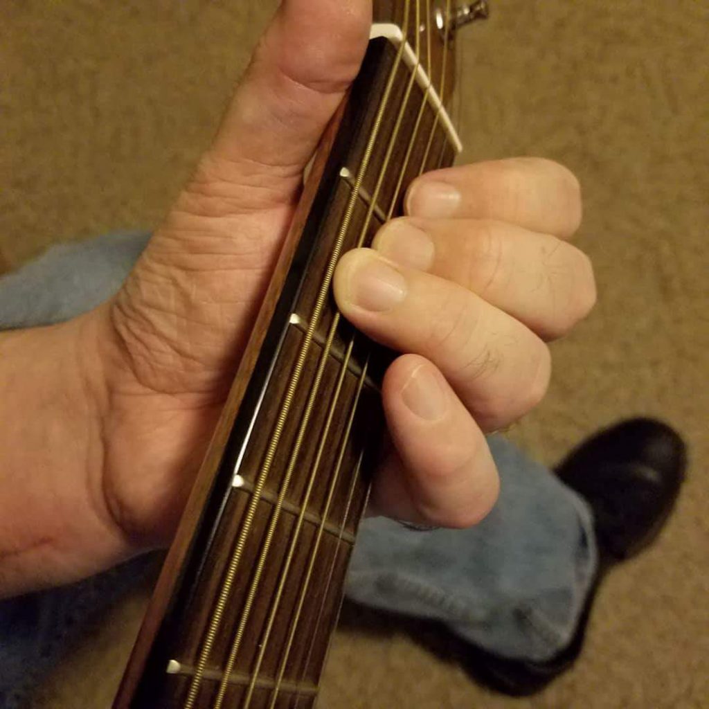 post-accident-guitar-playing-1024x1024